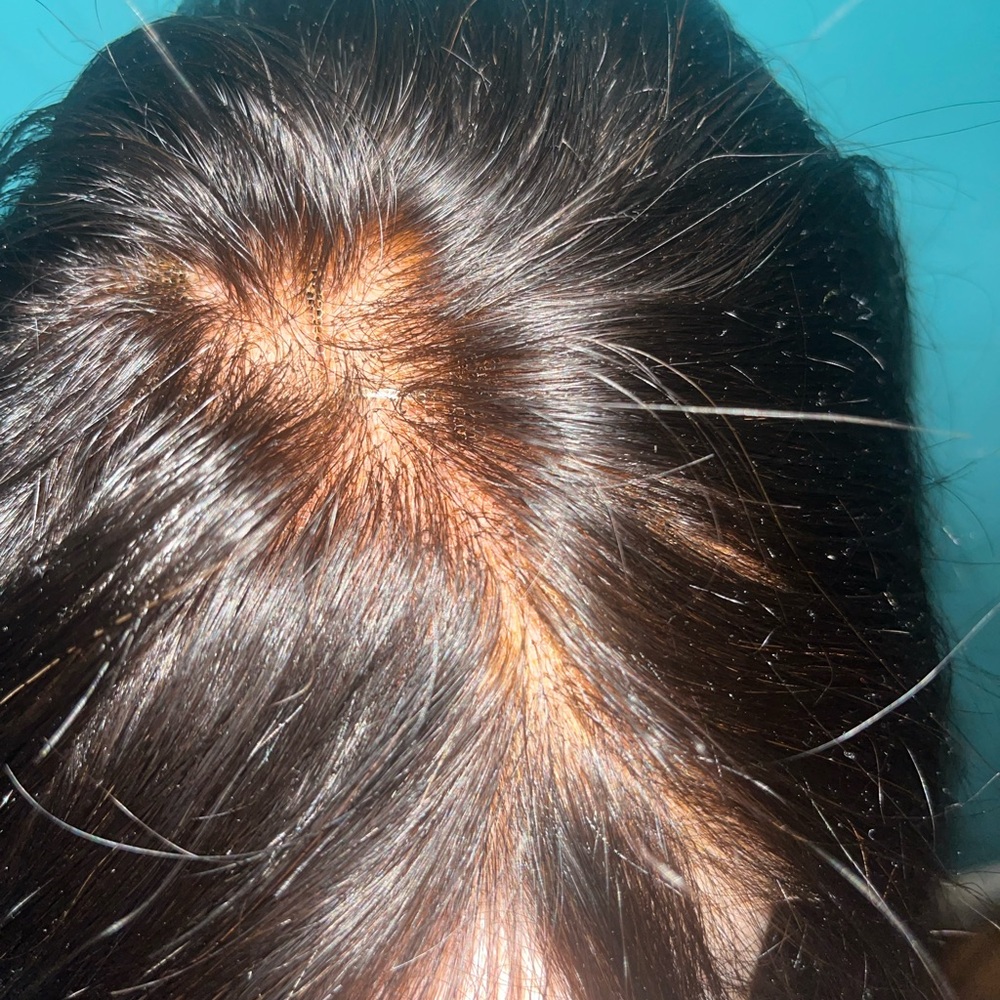 Glueless wig